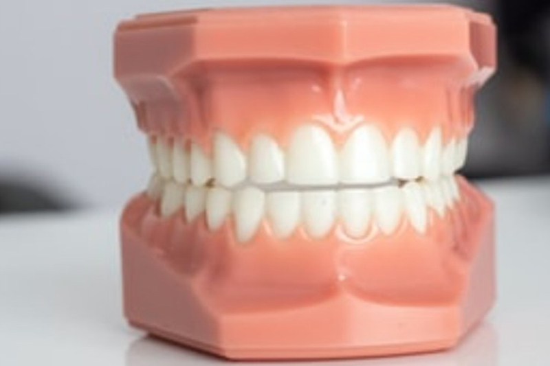 Zubne proteze Mina